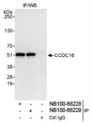 Immunoprecipitation: CCDC16 Antibody [NB100-68228] - Detection of Human CCDC16 by Western Blot of  Immunoprecipitates. Samples: Whole cell lysate (1 mg for IP,  20% of IP loaded) from HeLa cells. Antibodies: Affinity purified  rabbit anti-CCDC16 antibody NB100-68228 used for IP at 3  mcg/mg lysate. CCDC16 was also immunoprecipitated by rabbit  anti-CCDC16 antibody NB100-68229, which recognizes a  downstream epitope.   Detection: Chemiluminescence with an exposure time of 10  seconds.