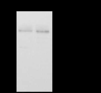 Immunoprecipitation: CCDC16 Antibody [NBP2-97135] - CCDC16 was immunoprecipitated using: Lane A: 0.5 mg Jurkat Whole Cell Lysate Lane B: 0.5 mg HeLa Whole Cell Lysate 4 ul anti-CCDC16 rabbit polyclonal antibody and 60 ug of Immunomagnetic beads Protein A/G.  Primary antibody: Anti-CCDC16 rabbit polyclonal antibody, at 1:100 dilution. Secondary antibody: Goat Anti-Rabbit IgG (H+L)/HRP at 1/10000 dilution. Developed using the ECL technique. Performed under reducing conditions. Predicted band size: 42 kDa. Observed band size: 49 kDa