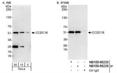 Western Blot: CCDC16 Antibody [NB100-68229] - Detection of Human CCDC16 on HeLa whole cell lysate using NB100-68229. CCDC16 was also  immunoprecipitated by rabbit anti-CCDC16 antibody NB100-68228.