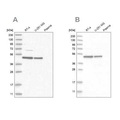 <b>Independent Antibodies Validation. </b>Western Blot: CCDC16 Antibody [NBP1-88164] - Analysis using Anti-ZNF830 antibody NBP1-88164 (A) shows similar pattern to independent antibody NBP1-88165 (B).