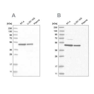 <b>Independent Antibodies Validation. </b>Western Blot: CCDC16 Antibody [NBP1-88165] - Analysis using Anti-ZNF830 antibody NBP1-88165 (A) shows similar pattern to independent antibody NBP1-88164 (B).