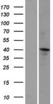 Western Blot: CCDC16 Overexpression Lysate (Adult Normal) [NBP2-05853] Left-Empty vector transfected control cell lysate (HEK293 cell lysate); Right -Over-expression Lysate for CCDC16.