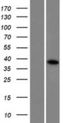 Western Blot: CCDC160 Overexpression Lysate (Adult Normal) [NBP2-09336] Left-Empty vector transfected control cell lysate (HEK293 cell lysate); Right -Over-expression Lysate for CCDC160.