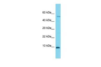 Western Blot: CCDC167 Antibody [NBP2-82562] - Host: Rabbit. Target Name: 1110021J02Rik. Sample Type: Mouse Small Intestine lysates. Antibody Dilution: 1.0ug/ml