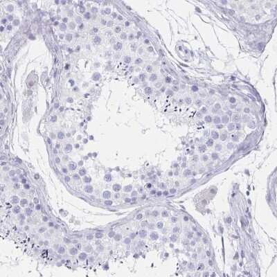 Immunohistochemistry-Paraffin: CCDC17 Antibody [NBP1-93860] - Staining of human testis shows low expression as expected.