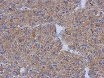 Immunohistochemistry-Paraffin: CCDC17 Antibody [NBP2-15746] - Immunohistochemical analysis of paraffin-embedded U87 xenograft, using antibody at 1:500 dilution.