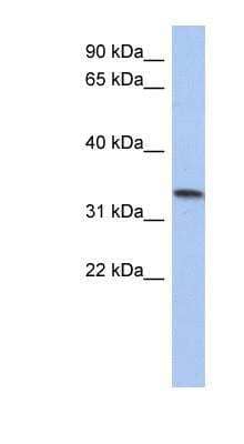 Western Blot: CCDC172 Antibody [NBP1-56323] - CCDC172 Human Placenta lysate, concentration 0.2-1 ug/ml.