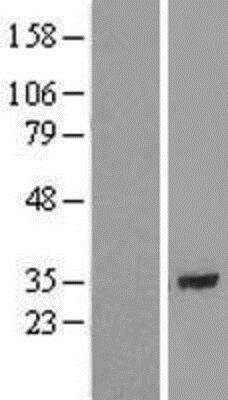 Western Blot CCDC172 Overexpression Lysate
