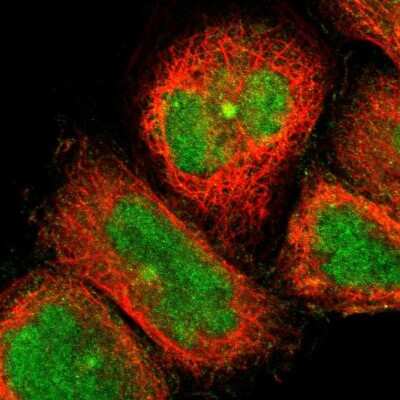 Immunocytochemistry/Immunofluorescence: CCDC176 Antibody [NBP1-91199] - Immunofluorescent staining of human cell line A-431 shows localization to nucleus & microtubule organizing center.