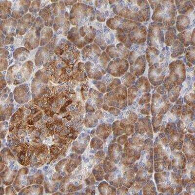 Immunohistochemistry CCDC176 Antibody - BSA Free