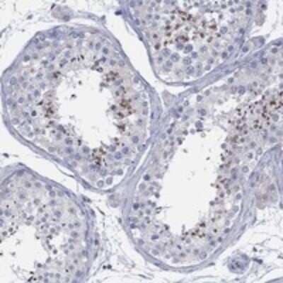Immunohistochemistry-Paraffin CCDC176 Antibody - BSA Free