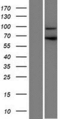 Western Blot: CCDC178 Overexpression Lysate (Native) [NBP2-04659] - CCDC178 Overexpression Lysate (Native) Left-Empty vector transfected control cell lysate (HEK293 cell lysate); Right -Over-expression Lysate for C18orf34.