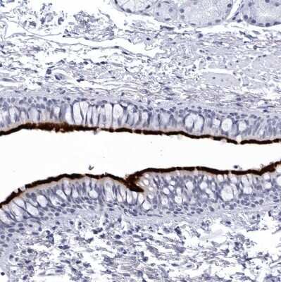 Immunohistochemistry-Paraffin: CCDC181 Antibody [NBP1-93898] - Staining of human bronchus shows strong positivity in respiratory epithelial cells.