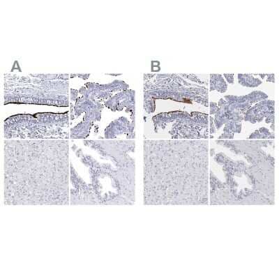 <b>Independent Antibodies Validation. </b>Immunohistochemistry-Paraffin: CCDC181 Antibody [NBP1-93898] - Staining of human bronchus, fallopian tube, liver and prostate using Anti-CCDC181 antibody NBP1-93898 (A) shows similar protein distribution across tissues to independent antibody NBP1-93899 (B).
