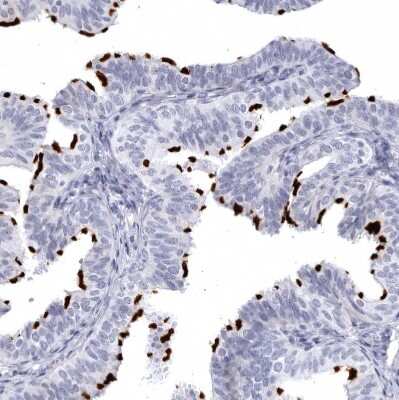 Immunohistochemistry-Paraffin: CCDC181 Antibody [NBP1-93898] - Staining of human Fallopian tube shows strong positivity in cilia in glandular cells.
