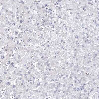 Immunohistochemistry-Paraffin: CCDC181 Antibody [NBP1-93898] - Staining of human liver shows no positivity in hepatocytes as expected.