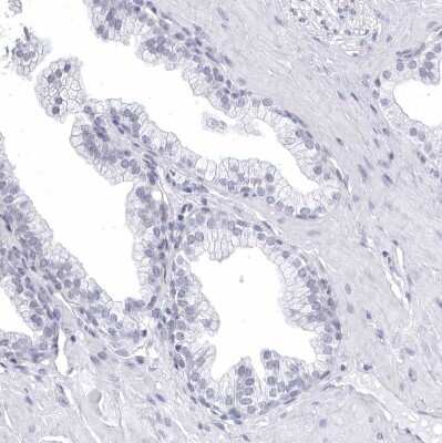Immunohistochemistry-Paraffin: CCDC181 Antibody [NBP1-93898] - Staining of human prostate shows no positivity in glandular cells as expected.