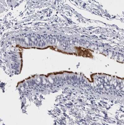 Immunohistochemistry-Paraffin: CCDC181 Antibody [NBP1-93899] - Staining of human bronchus shows strong positivity in respiratory epithelial cells.