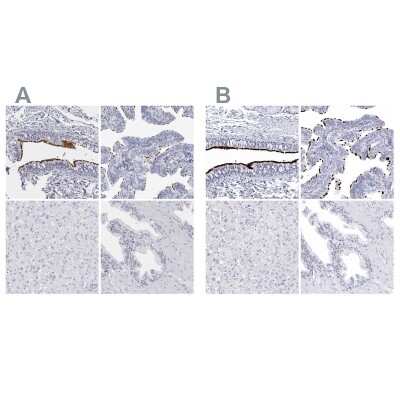 <b>Independent Antibodies Validation. </b>Immunohistochemistry-Paraffin: CCDC181 Antibody [NBP1-93899] - Staining of human bronchus, fallopian tube, liver and prostate using Anti-CCDC181 antibody NBP1-93899 (A) shows similar protein distribution across tissues to independent antibody NBP1-93898 (B).