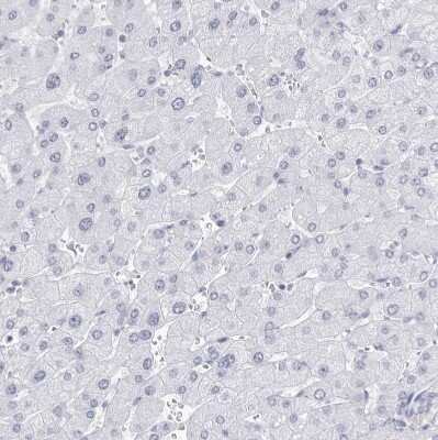 Immunohistochemistry-Paraffin: CCDC181 Antibody [NBP1-93899] - Staining of human liver shows no positivity in hepatocytes as expected.