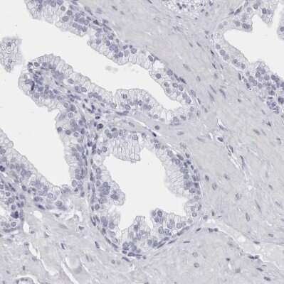 Immunohistochemistry-Paraffin: CCDC181 Antibody [NBP1-93899] - Staining of human prostate shows no positivity in glandular cells as expected.