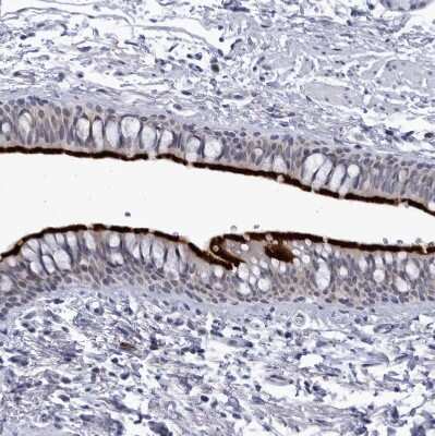Immunohistochemistry-Paraffin: CCDC181 Antibody [NBP1-93900] - Staining of human bronchus shows strong positivity in respiratory epithelial cells.