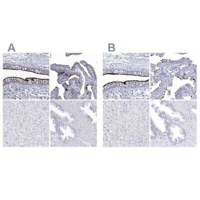 <b>Independent Antibodies Validation. </b>Immunohistochemistry-Paraffin: CCDC181 Antibody [NBP1-93900] - Staining of human bronchus, fallopian tube, liver and prostate using Anti-CCDC181 antibody NBP1-93900 (A) shows similar protein distribution across tissues to independent antibody NBP1-93898 (B).