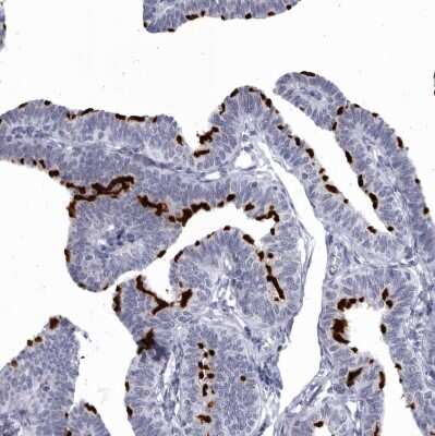 Immunohistochemistry-Paraffin: CCDC181 Antibody [NBP1-93900] - Staining of human Fallopian tube shows strong positivity in cilia in glandular cells.