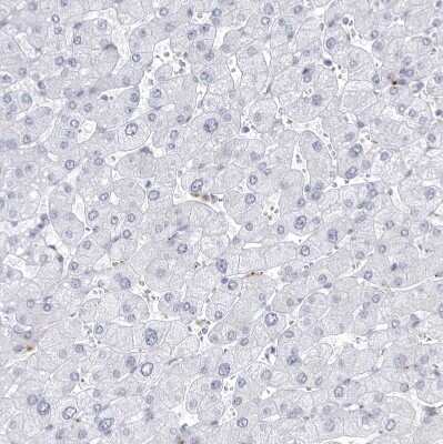 Immunohistochemistry-Paraffin: CCDC181 Antibody [NBP1-93900] - Staining of human liver shows no positivity in hepatocytes as expected.
