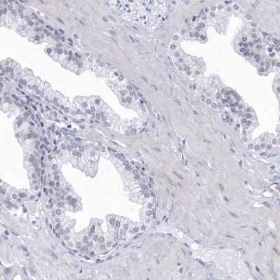 Immunohistochemistry-Paraffin: CCDC181 Antibody [NBP1-93900] - Staining of human prostate shows no positivity in glandular cells as expected.