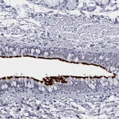 Immunohistochemistry-Paraffin: CCDC181 Antibody [NBP1-93901] - Staining of human bronchus shows strong positivity in respiratory epithelial cells.