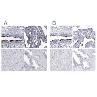 Immunohistochemistry-Paraffin: CCDC181 Antibody [NBP1-93901] - Staining of human bronchus, fallopian tube, liver and prostate using Anti-CCDC181 antibody NBP1-93901 (A) shows similar protein distribution across tissues to independent antibody NBP1-93898 (B).