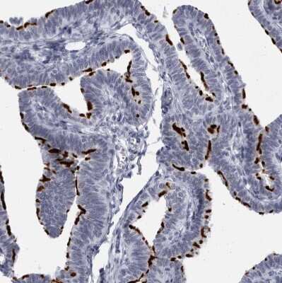 Immunohistochemistry-Paraffin: CCDC181 Antibody [NBP1-93901] - Staining of human Fallopian tube shows strong positivity in cilia in glandular cells.