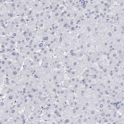 Immunohistochemistry-Paraffin: CCDC181 Antibody [NBP1-93901] - Staining of human liver shows no positivity in hepatocytes as expected.