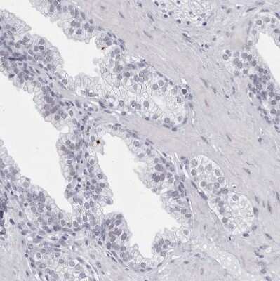Immunohistochemistry-Paraffin: CCDC181 Antibody [NBP1-93901] - Staining of human prostate shows no positivity in glandular cells as expected.