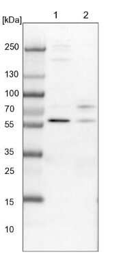 Western Blot: CCDC181 Antibody [NBP1-93901] - Lane 1: NIH-3T3 cell lysate (Mouse embryonic fibroblast cells). Lane 2: NBT-II cell lysate (Rat Wistar bladder tumor cells).