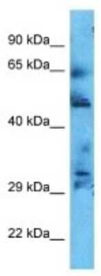 Western Blot: CCDC181 Antibody [NBP3-10643] - Western blot analysis of CCDC181 in Ovary Tumor lysates. Antibody dilution at 1.0ug/ml