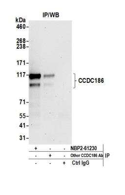 CCDC186 Antibody [NBP2-61230] - Detection of human CCDC186 by western blot of immunoprecipitates. Samples: Whole cell lysate (1.0 mg per IP reaction; 20% of IP loaded) from HeLa cells prepared using NETN lysis buffer. Antibodies: Affinity purified rabbit anti-CCDC186 antibody NBP2-61230 used for IP at 8 ul per reaction. CCDC186 was also immunoprecipitated by another rabbit anti-CCDC186 antibody. Detection: Chemiluminescence with an exposure time of 30 seconds.