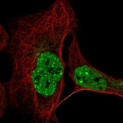 Immunocytochemistry/Immunofluorescence: CCDC188 Antibody [NBP2-55782] - Staining of human cell line U-2 OS shows localization to nucleoplasm & nuclear bodies. Antibody staining is shown in green.