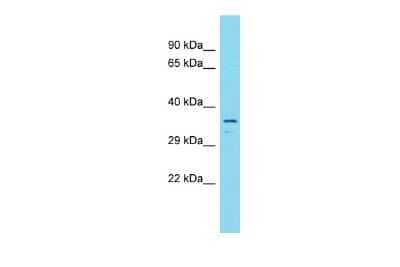 Western Blot: CCDC189 Antibody [NBP2-84605] - Host: Rabbit. Target Name: C16orf93. Sample Type: Fetal Brain lysates. Antibody Dilution: 1.0ug/ml