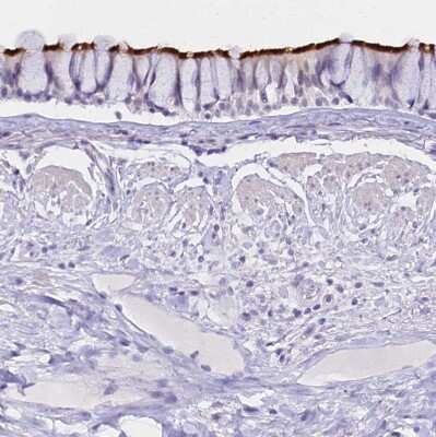 Immunohistochemistry-Paraffin: CCDC19 Antibody [NBP1-91758] - Staining of human bronchus shows strong positivity in cilia of respiratory epithelial cells.