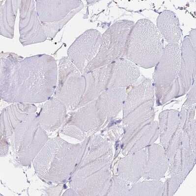 Immunohistochemistry-Paraffin: CCDC19 Antibody [NBP1-91758] - Staining of human skeletal muscle shows no positivity in myocytes as expected.