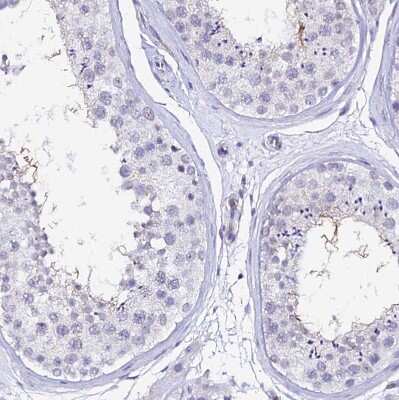 Immunohistochemistry-Paraffin: CCDC19 Antibody [NBP1-91758] - Staining of human testis shows moderate positivity in flagellum of spermatozoa.