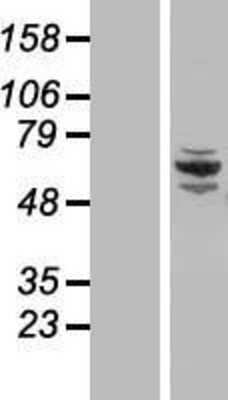 Western Blot: CCDC22 Overexpression Lysate (Adult Normal) [NBL1-08785] Left-Empty vector transfected control cell lysate (HEK293 cell lysate); Right -Over-expression Lysate for CCDC22.