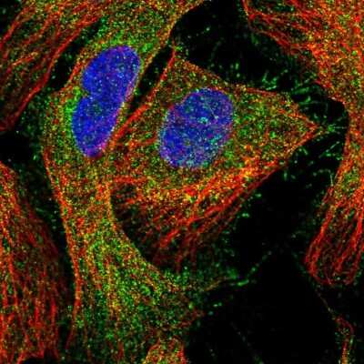 Immunocytochemistry/Immunofluorescence: CCDC24 Antibody [NBP2-56417] - Staining of human cell line U-2 OS shows localization to plasma membrane & cytosol.