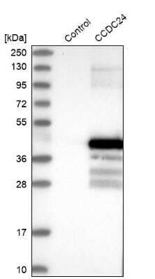 Western Blot: CCDC24 Antibody [NBP2-34179] - Analysis in control (vector only transfected HEK293T lysate) and CCDC24 over-expression lysate (Co-expressed with a C-terminal myc-DDK tag (3.1 kDa) in mammalian HEK293T cells).