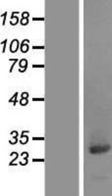 Western Blot: CCDC25 Overexpression Lysate (Adult Normal) [NBL1-08788] Left-Empty vector transfected control cell lysate (HEK293 cell lysate); Right -Over-expression Lysate for CCDC25.