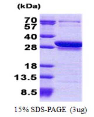 SDS-Page: Recombinant Human CCDC25 Protein [NBP2-22788]