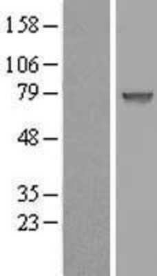 Western Blot: CCDC27 Overexpression Lysate (Adult Normal) [NBL1-08789] Left-Empty vector transfected control cell lysate (HEK293 cell lysate); Right -Over-expression Lysate for CCDC27.