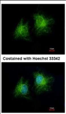 Immunocytochemistry/ Immunofluorescence CCDC28B Antibody